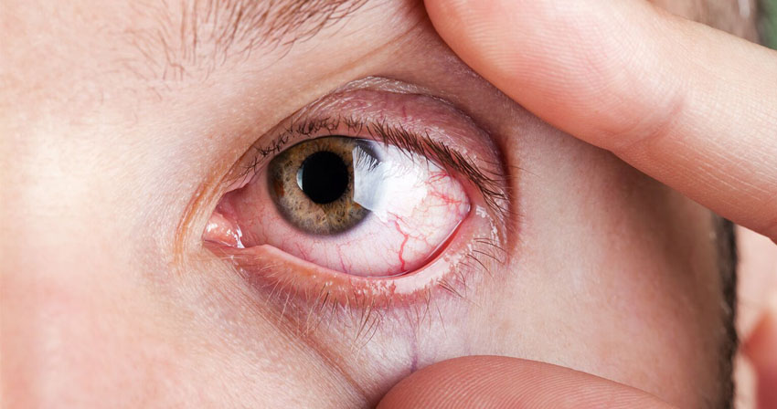 do-no-ignore-minor-eye-problems