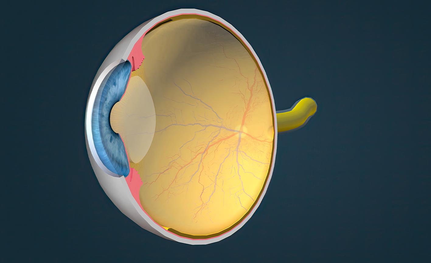 cornea-treatment-in-delhi